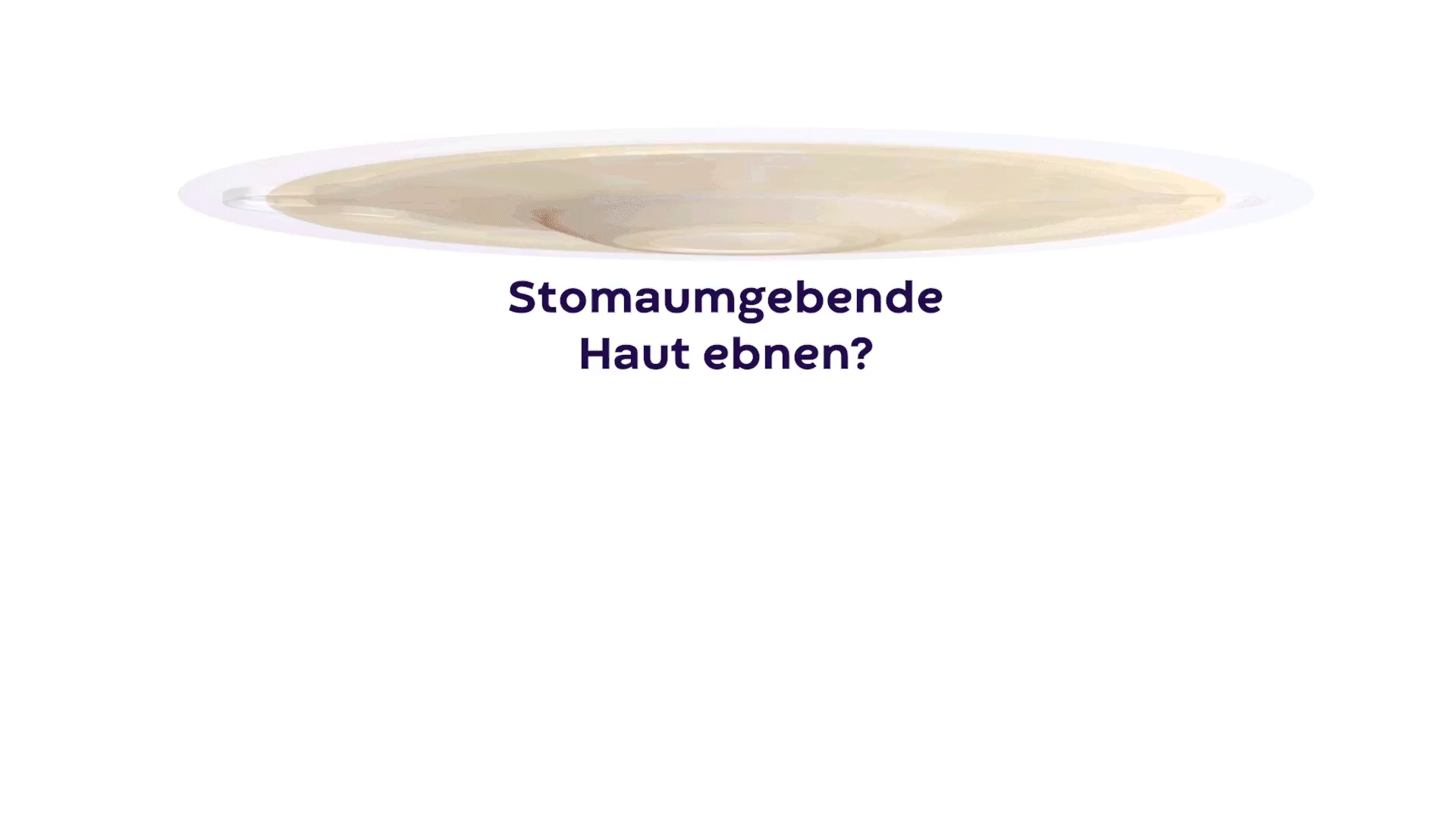 Video wie eine konvexe Versorgung die Haut um das Stoma glätten kann