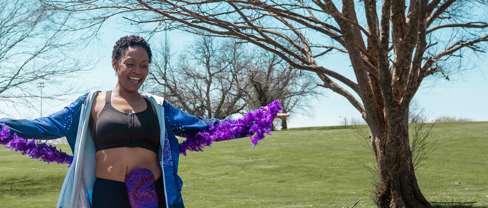 a woman with an ostomy pouch wearing a feather boa