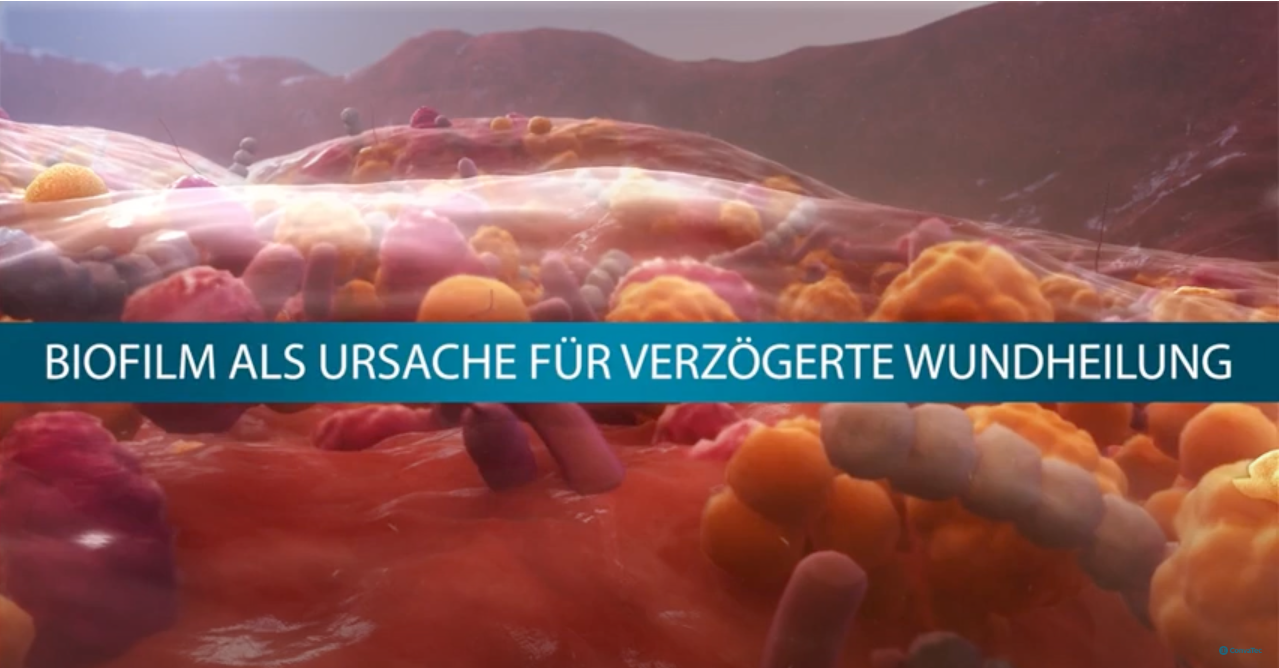 Grafische Benutzeroberfläche, Text