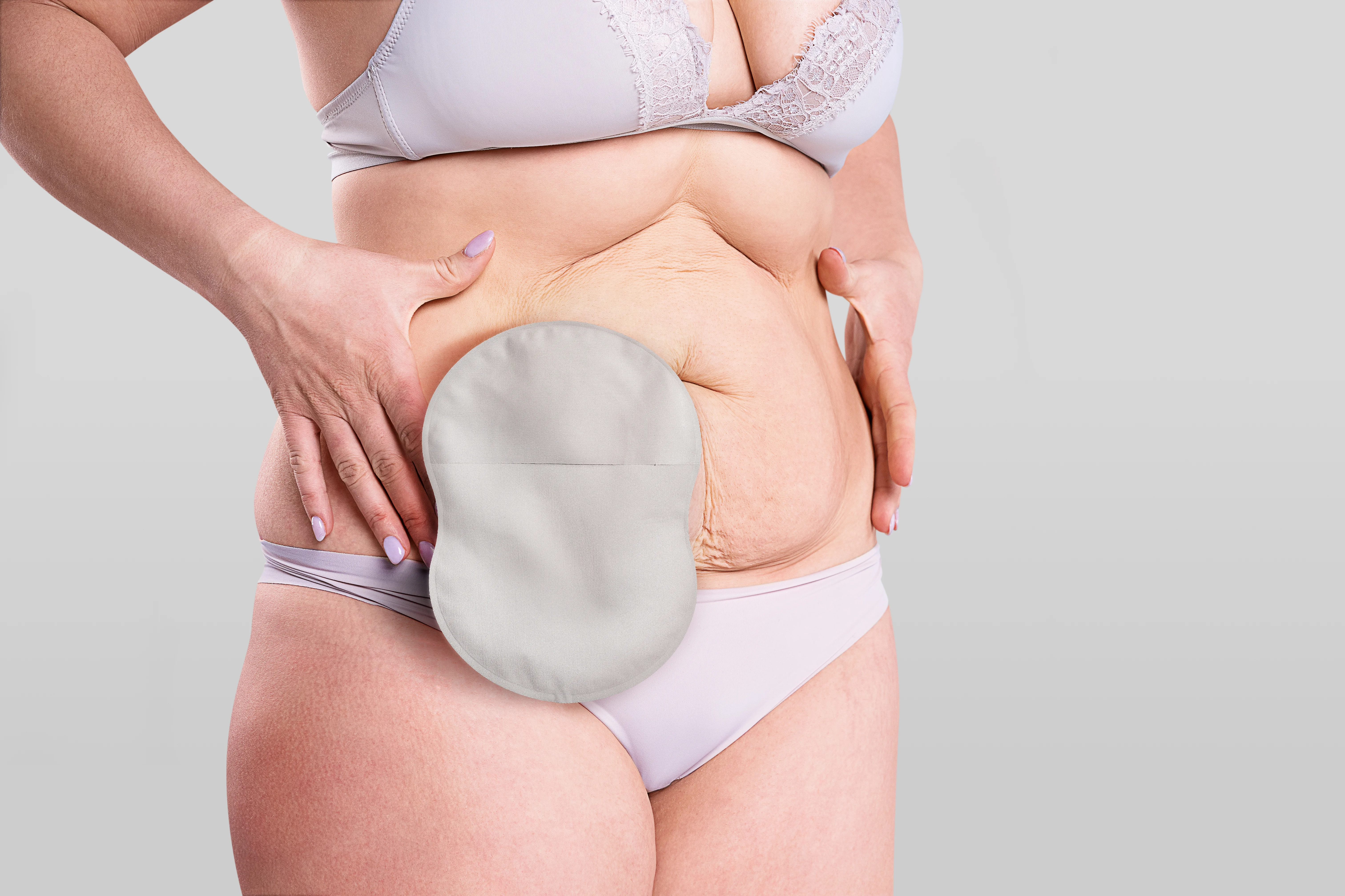 Stomisée avec sac Esteem Body