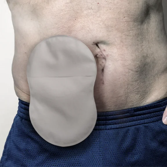 Detailný záber muža so stomickým vreckom v tvare 8 s Leak Defense™.