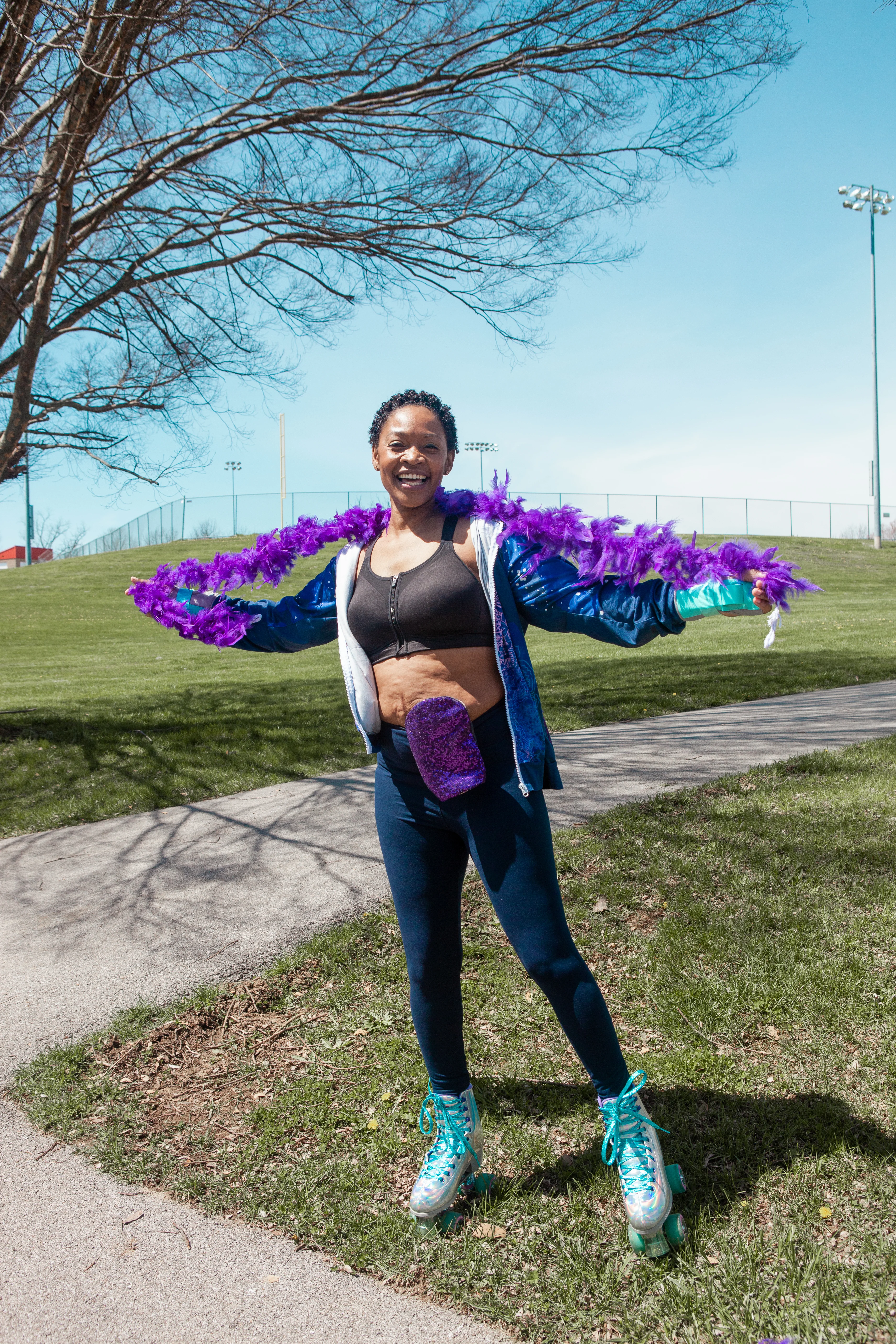 a woman with an ostomy